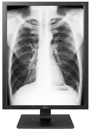 LG Medical Display 21HQ513D-S